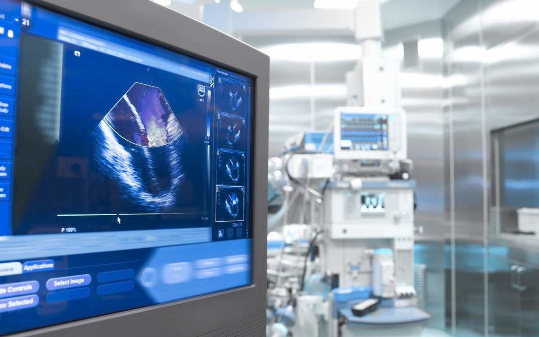 ECOCARDIOGRAFIA EN MODO POCUS